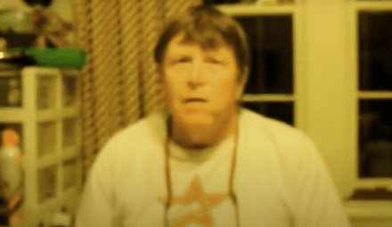 Amputation of Multiple Fingers