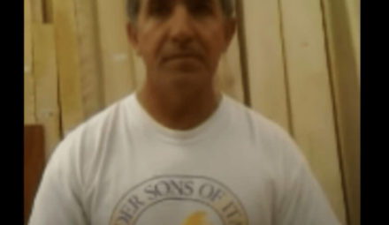 Two Amputated Fingers