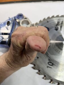 New SawStop Prevents Serious Injury 